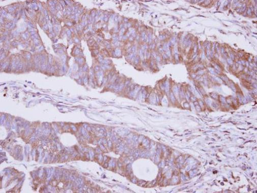 MAN2B2 Antibody in Immunohistochemistry (Paraffin) (IHC (P))
