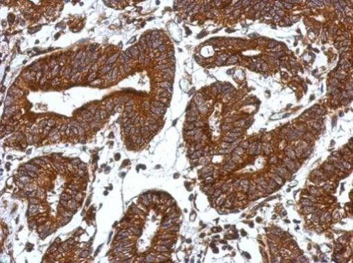 ORAI2 Antibody in Immunohistochemistry (Paraffin) (IHC (P))