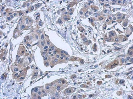 PYROXD2 Antibody in Immunohistochemistry (Paraffin) (IHC (P))