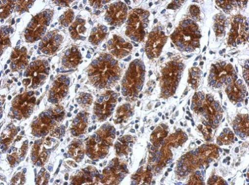 RILPL2 Antibody in Immunohistochemistry (Paraffin) (IHC (P))