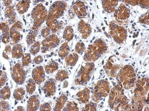 SEL1L3 Antibody in Immunohistochemistry (Paraffin) (IHC (P))