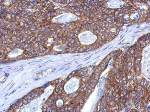 SLITRK5 Antibody in Immunohistochemistry (Paraffin) (IHC (P))