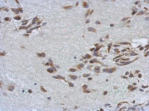 SSFA2 Antibody in Immunohistochemistry (Paraffin) (IHC (P))