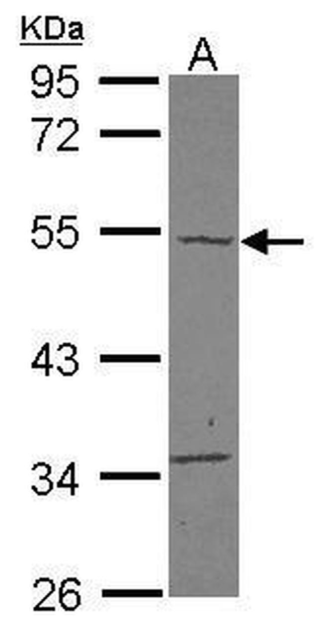 Carabin Antibody in Western Blot (WB)