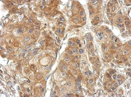 TSR2 Antibody in Immunohistochemistry (Paraffin) (IHC (P))
