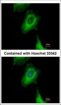 UBXN1 Antibody in Immunocytochemistry (ICC/IF)