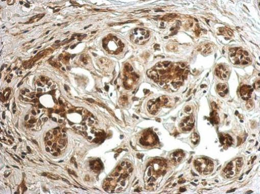 CC2D2B Antibody in Immunohistochemistry (Paraffin) (IHC (P))
