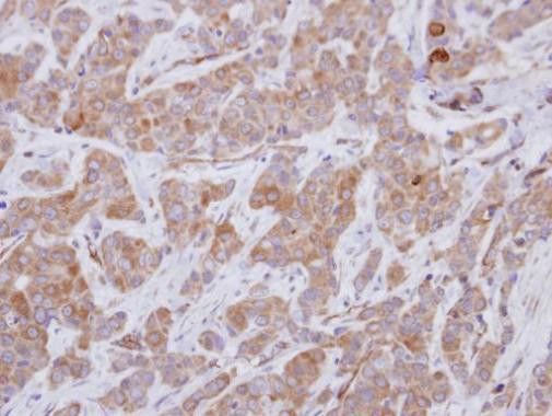 GEFT Antibody in Immunohistochemistry (Paraffin) (IHC (P))