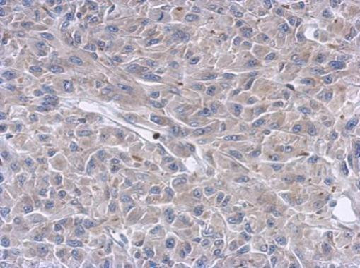Cytokeratin 36 Antibody in Immunohistochemistry (Paraffin) (IHC (P))