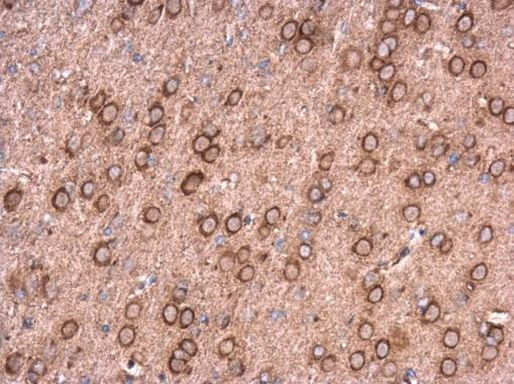 NCALD Antibody in Immunohistochemistry (Paraffin) (IHC (P))