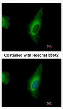 ORP8 Antibody in Immunocytochemistry (ICC/IF)