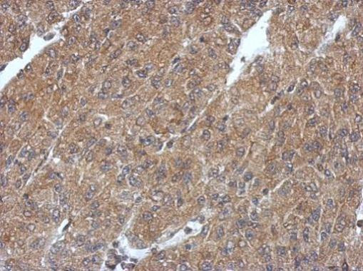 PHYHIP Antibody in Immunohistochemistry (Paraffin) (IHC (P))