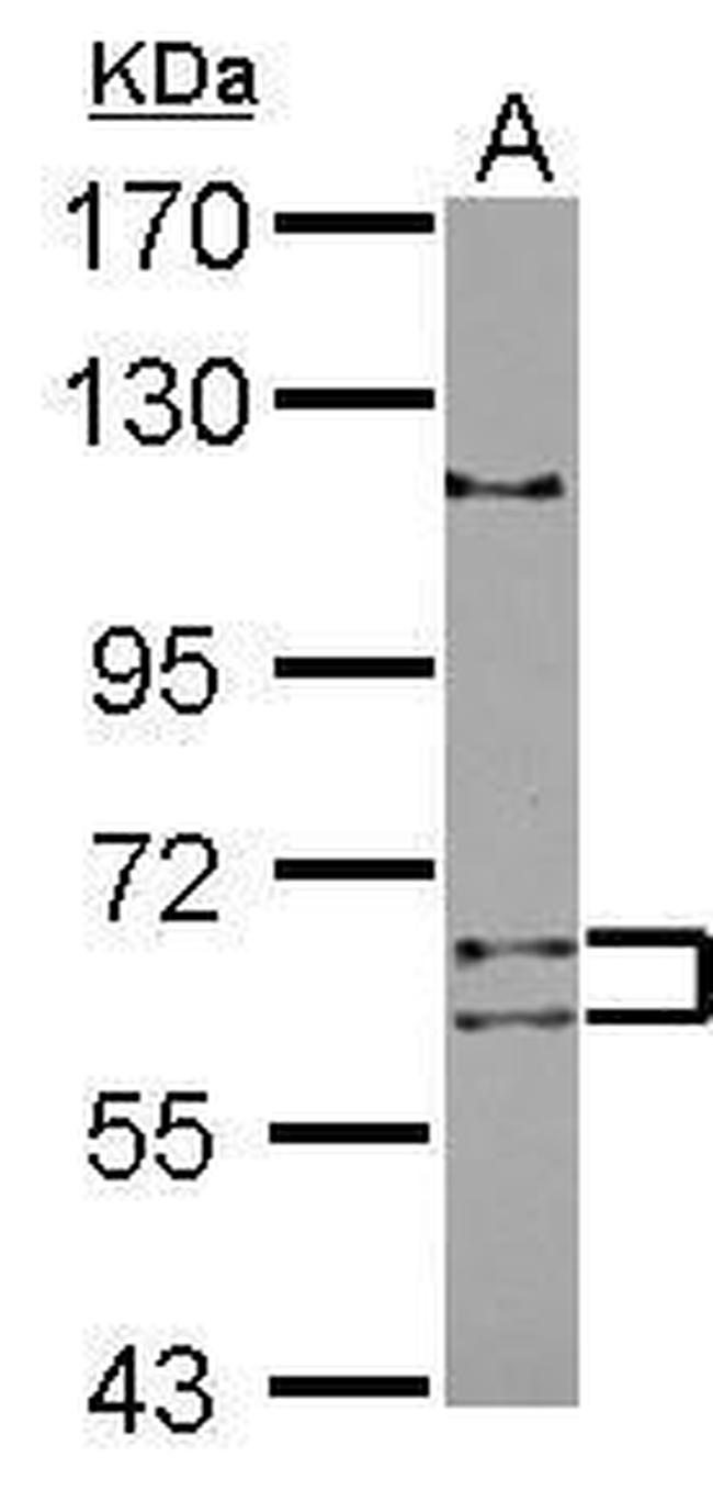 TENR Antibody in Western Blot (WB)