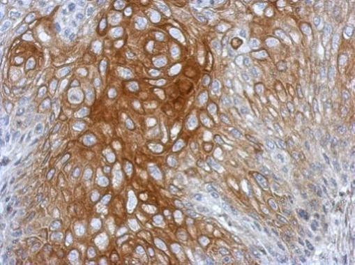 BRD9 Antibody in Immunohistochemistry (Paraffin) (IHC (P))