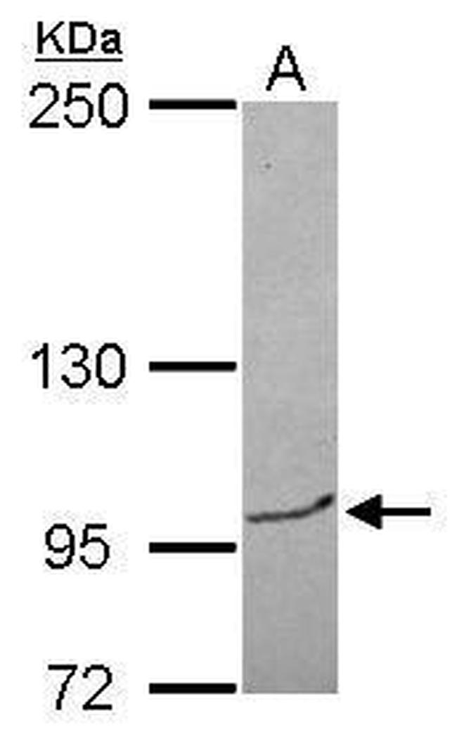 BRPF3 Antibody in Western Blot (WB)