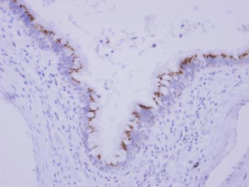 CGI-62 Antibody in Immunohistochemistry (Paraffin) (IHC (P))