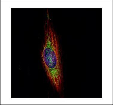 WDR16 Antibody in Immunocytochemistry (ICC/IF)
