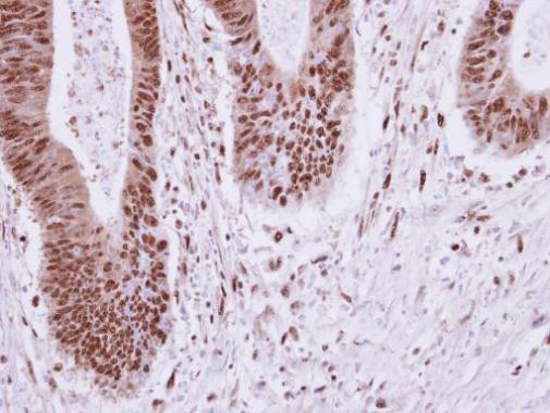 ELP2 Antibody in Immunohistochemistry (Paraffin) (IHC (P))