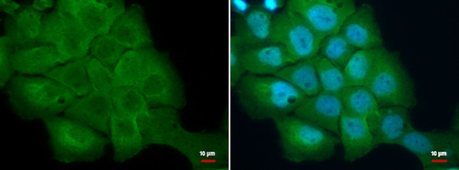 S100A2 Antibody in Immunocytochemistry (ICC/IF)