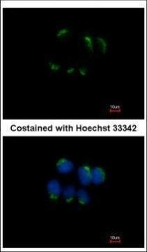 TFF1 Antibody in Immunocytochemistry (ICC/IF)
