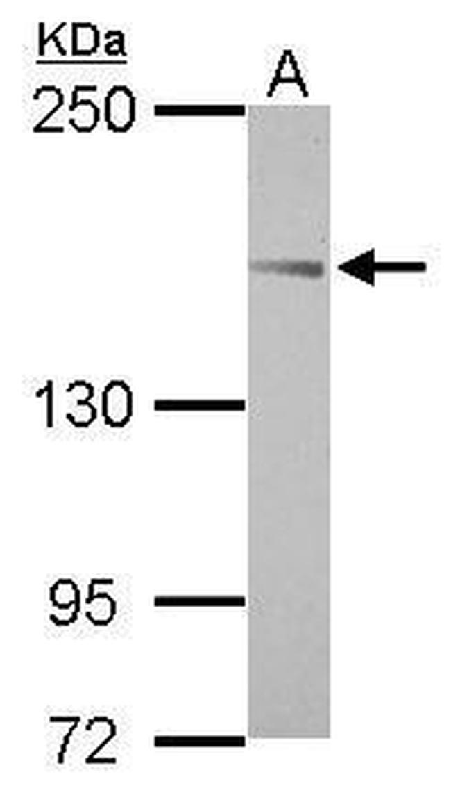 ABI3BP Antibody in Western Blot (WB)