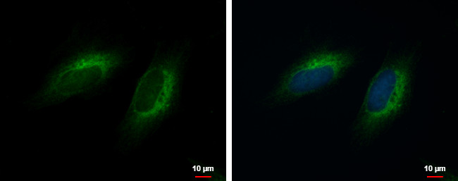 COMMD10 Antibody in Immunocytochemistry (ICC/IF)