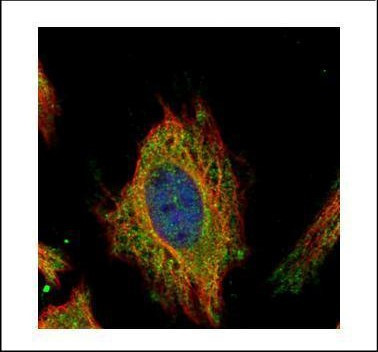 FEM1C Antibody in Immunocytochemistry (ICC/IF)