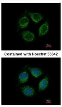LRRC4C Antibody in Immunocytochemistry (ICC/IF)