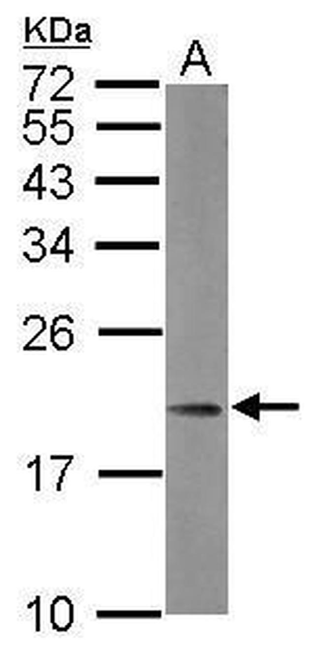 MRPL21 Antibody in Western Blot (WB)