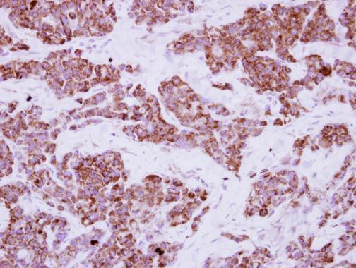 LRRC23 Antibody in Immunohistochemistry (Paraffin) (IHC (P))