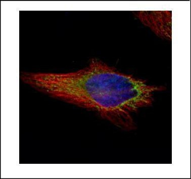 NAPRT1 Antibody in Immunocytochemistry (ICC/IF)