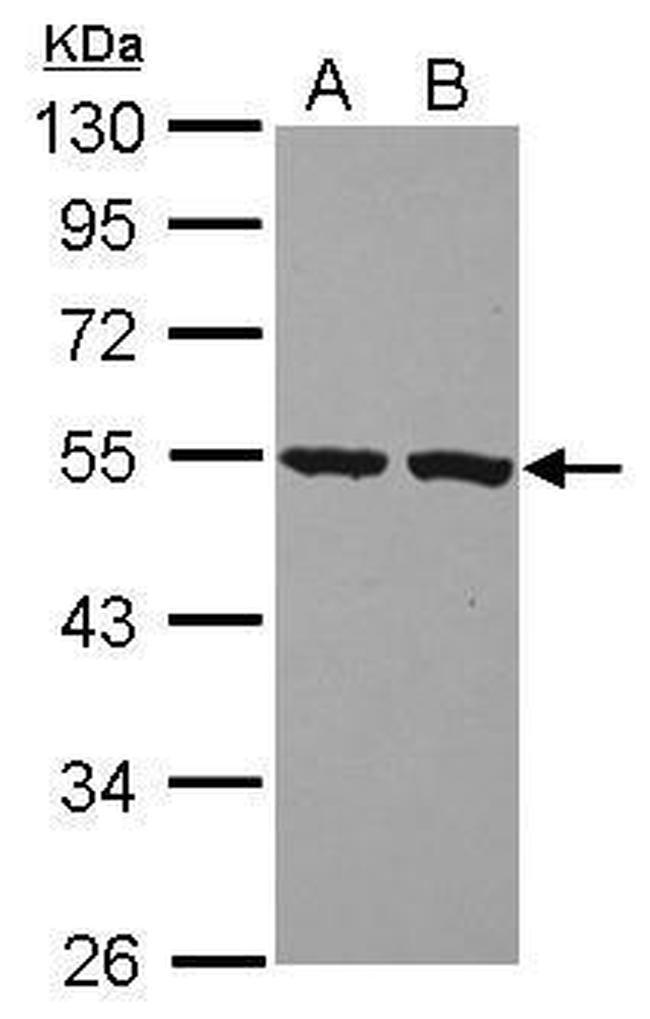 PI16 Antibody in Western Blot (WB)