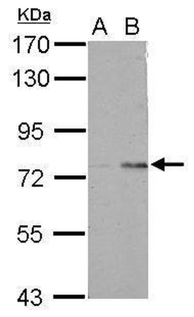 POLR3E Antibody in Western Blot (WB)