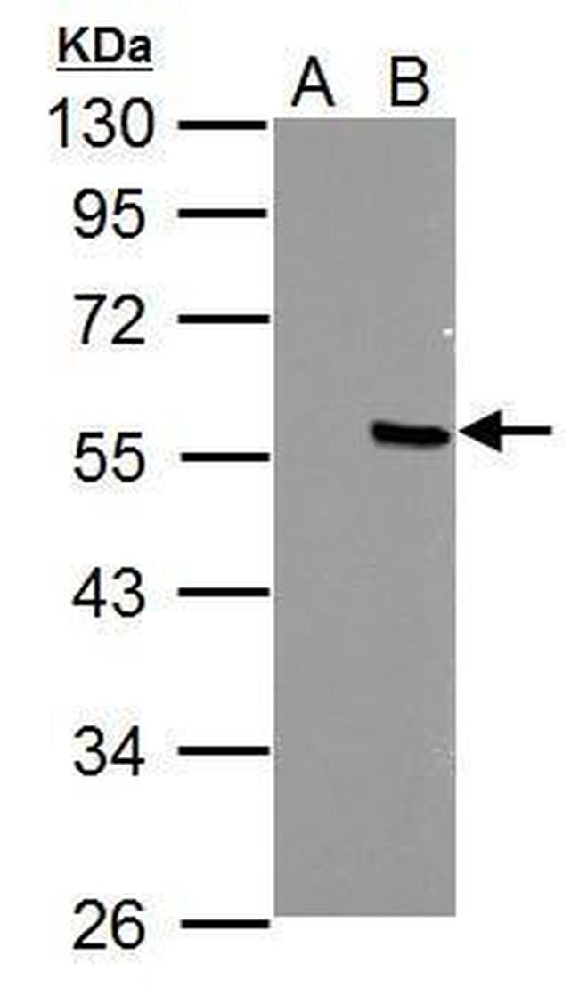 PPP4R2 Antibody in Western Blot (WB)