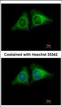RASA4 Antibody in Immunocytochemistry (ICC/IF)