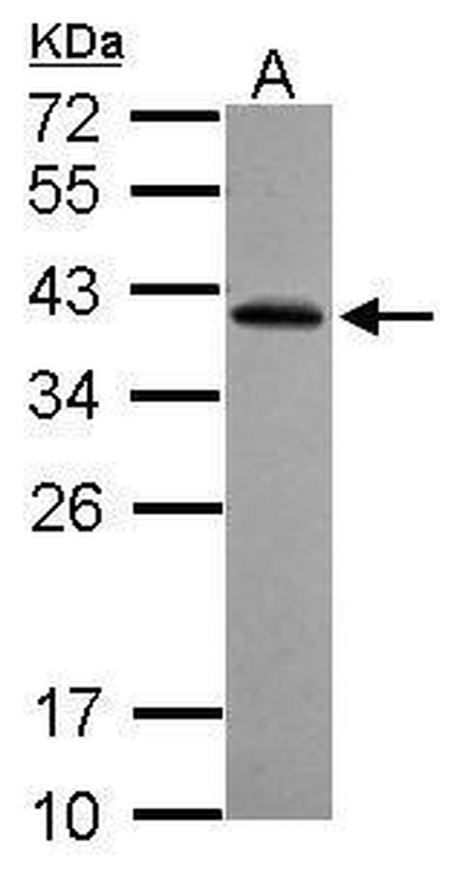 RFPL2 Antibody in Western Blot (WB)