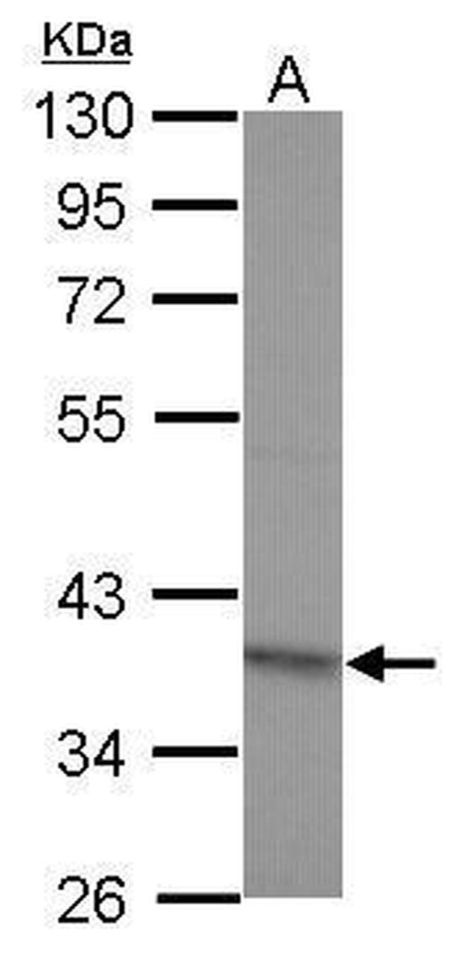 RG9MTD2 Antibody in Western Blot (WB)