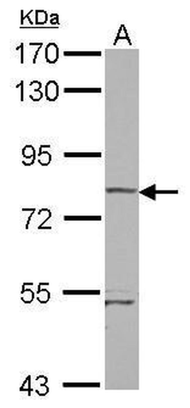 RhoBTB1 Antibody in Western Blot (WB)