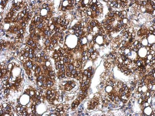 STS1 Antibody in Immunohistochemistry (Paraffin) (IHC (P))