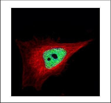ZNF302 Antibody in Immunocytochemistry (ICC/IF)