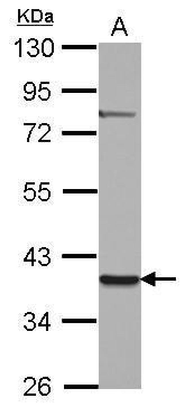 ZNF302 Antibody in Western Blot (WB)
