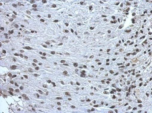 ZNF649 Antibody in Immunohistochemistry (Paraffin) (IHC (P))