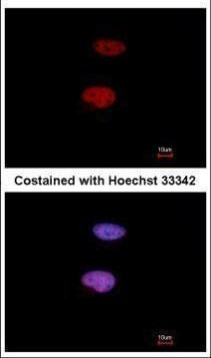 Phospho-Histone H1.4 (Ser35) Antibody in Immunocytochemistry (ICC/IF)