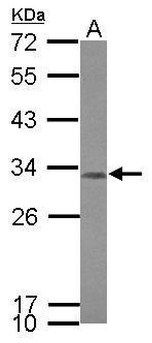 CCDC44 Antibody in Western Blot (WB)
