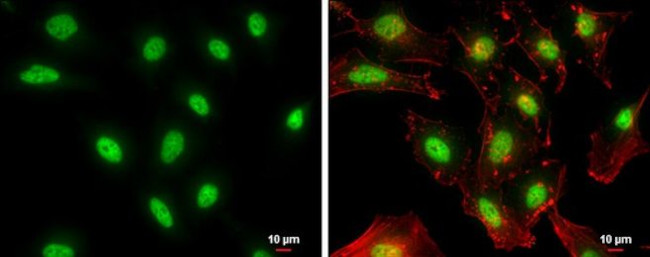NFYB Antibody in Immunocytochemistry (ICC/IF)