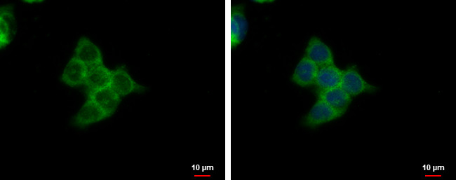 SMYD3 Antibody in Immunocytochemistry (ICC/IF)
