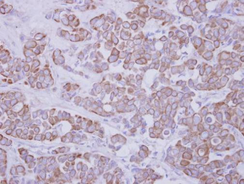 GTDC1 Antibody in Immunohistochemistry (Paraffin) (IHC (P))