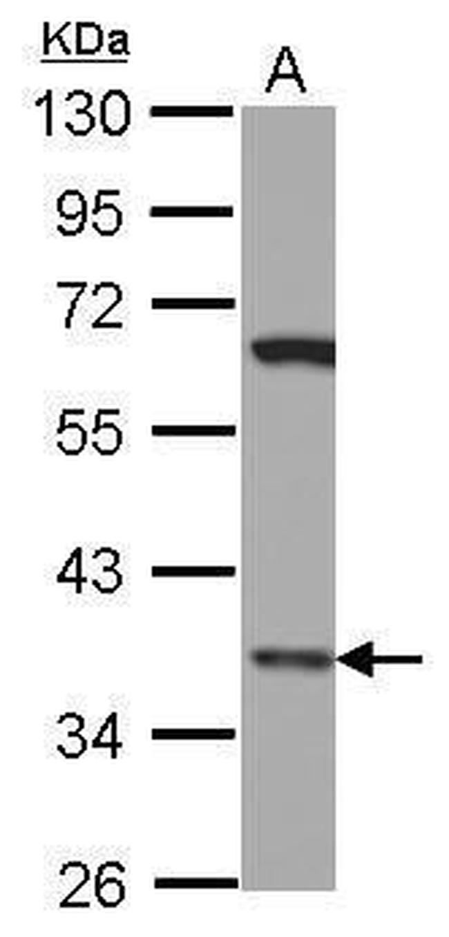 LHX8 Antibody in Western Blot (WB)