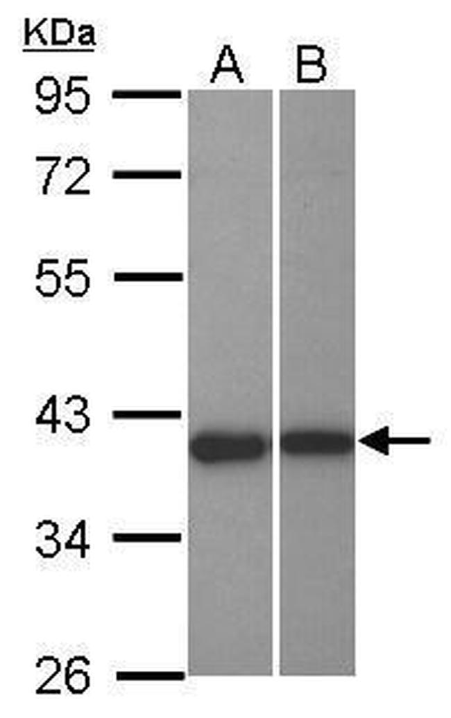 LRRC23 Antibody in Western Blot (WB)