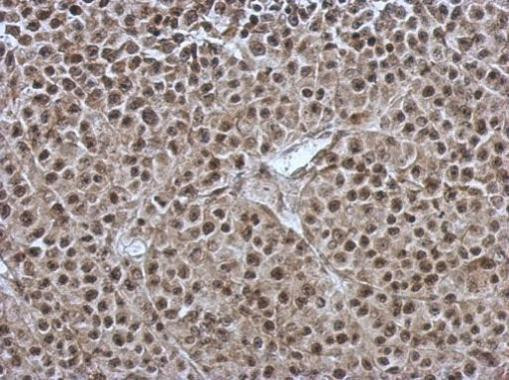 ORP9 Antibody in Immunohistochemistry (Paraffin) (IHC (P))